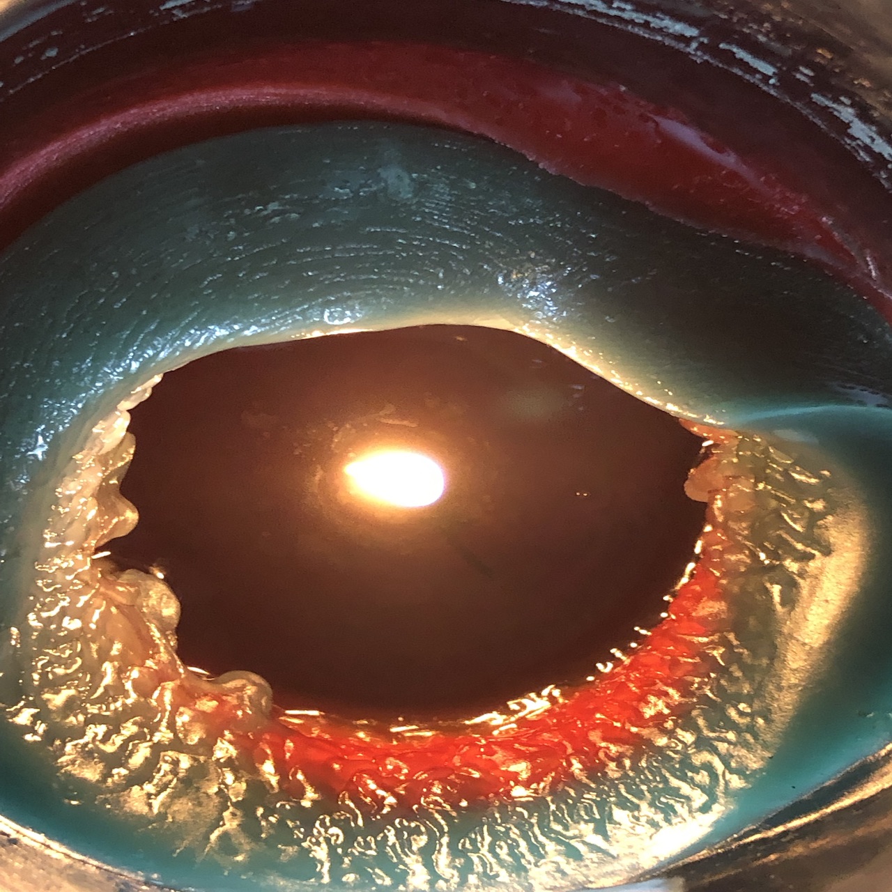 The Search for Eternal Flame